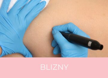 okladka galeria blizny